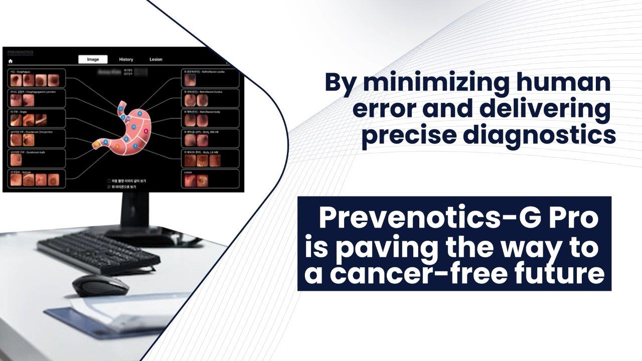 Prevenotics-G Pro: AI Gastric Cancer Prevention Solution